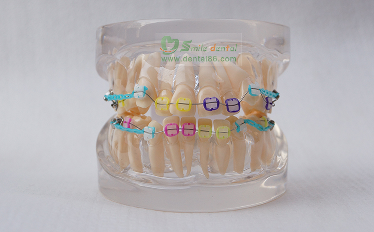 TM-B2-03 Orthodontic Model